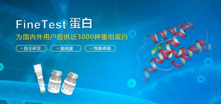 人源CDK1重组蛋白(Recombinant Human CDK_da458719.jpg